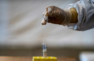 Koronavirüs test kiti Türkiye’de üretilecek! İşte tüm detaylar koronovirüs salgınından daha kötüsü