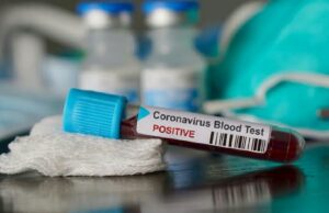 BioNTech Şirketi Türkiye Ofisi Açabilir: Aşı Ucuza Mı Gelecek ABD milyonlarca doz aşı