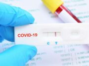 Sahte Kovid 19 Test Kiti E-Mail’lerine Dikkat Edin! Çünkü…