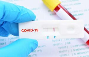 Sahte Kovid 19 Test Kiti E-Mail’lerine Dikkat Edin! Çünkü…