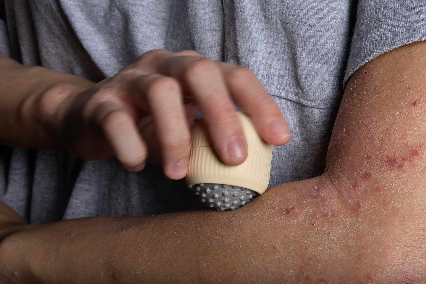 James Dyson Ödülü